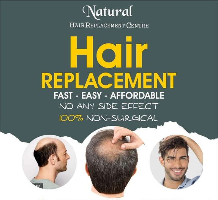 Natural Hair Replacement Center